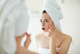 How does fungal acne affect you?